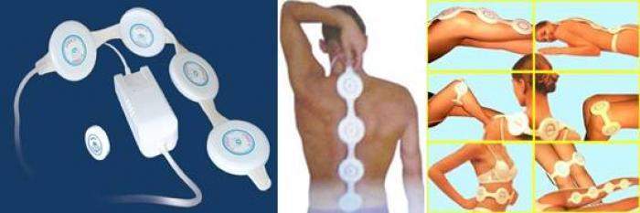 MAGNETIC DEFICIENCY SYNDROME