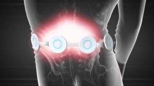 Finding the Best Pulsed Electromagnetic Field Therapy Devices