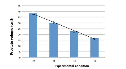 Nonsurgical treatment for enlarged prostate on the horizon